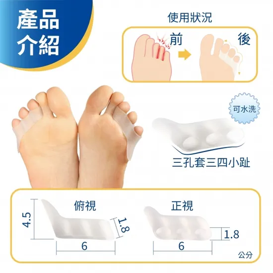 腳趾重疊與小趾內翻不再痛：專屬分趾器與防護對策