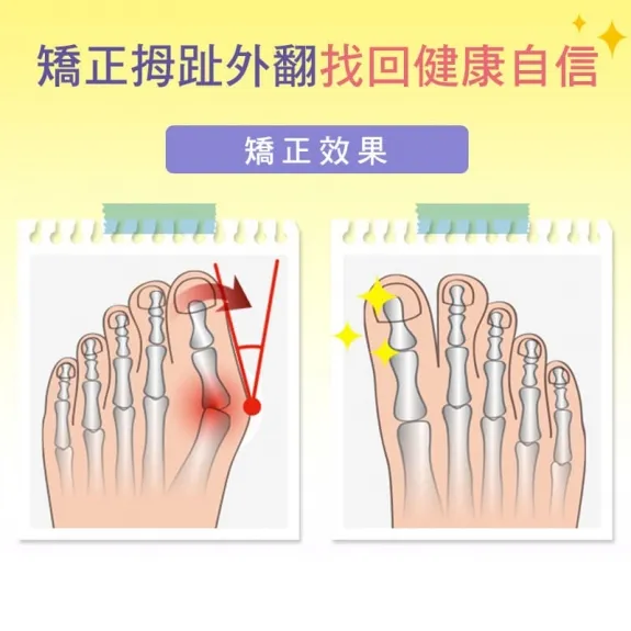 從腳跟痛到足底不適:全方位足部痛症舒緩與保養