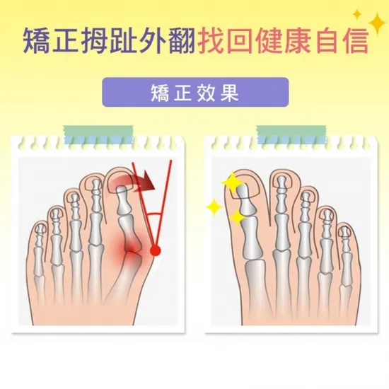 從腳跟痛到足底不適：全方位足部痛症舒緩與保養