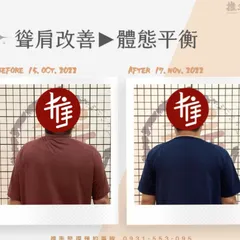 新北三重整復教學