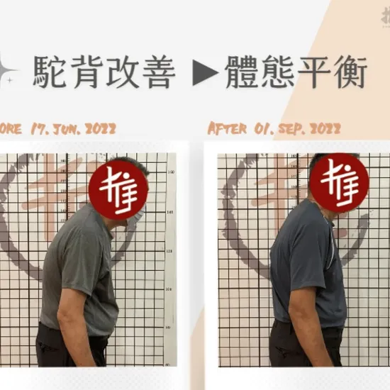 改善腰痠的運動與伸展：推拿後如何維持調理效果？