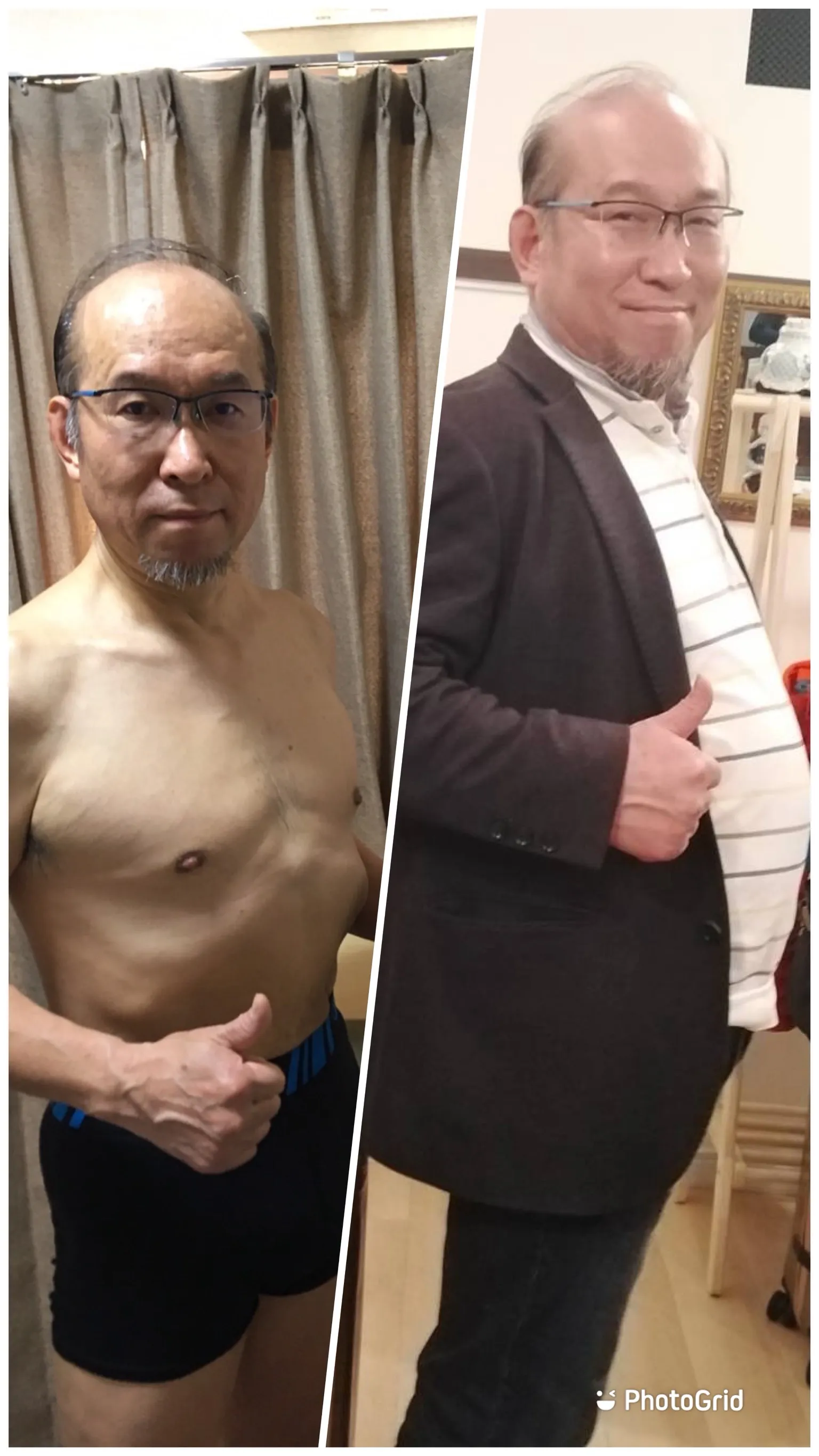 逆轉糖尿病