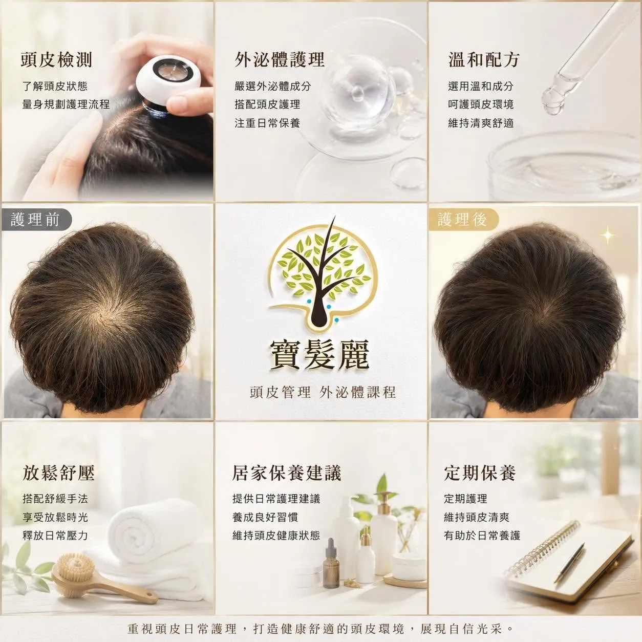 頭皮管理