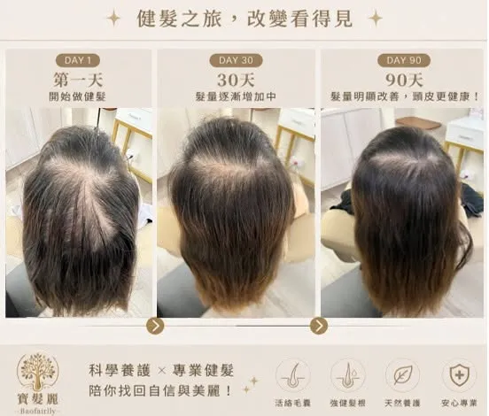 頭皮管理