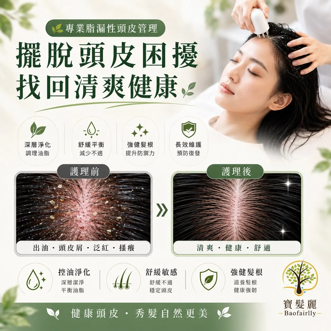 頭皮管理