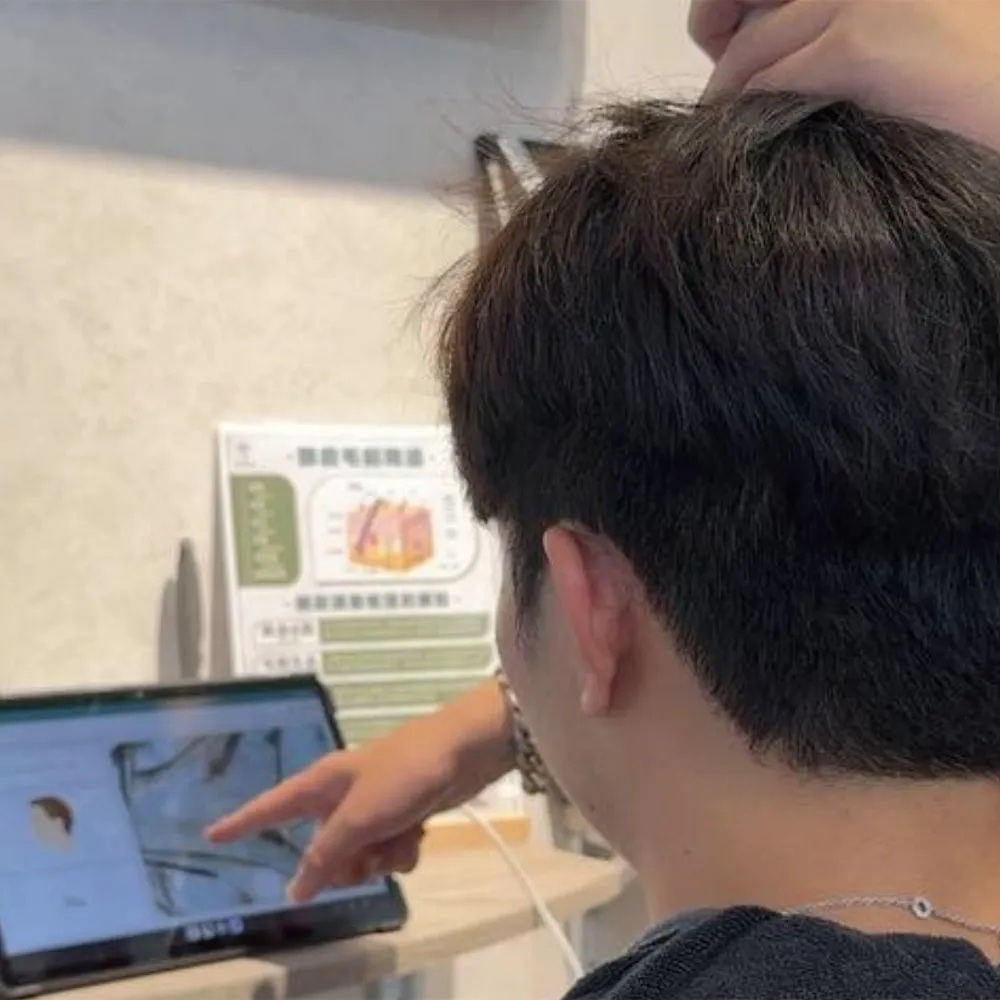 頭皮養護推薦