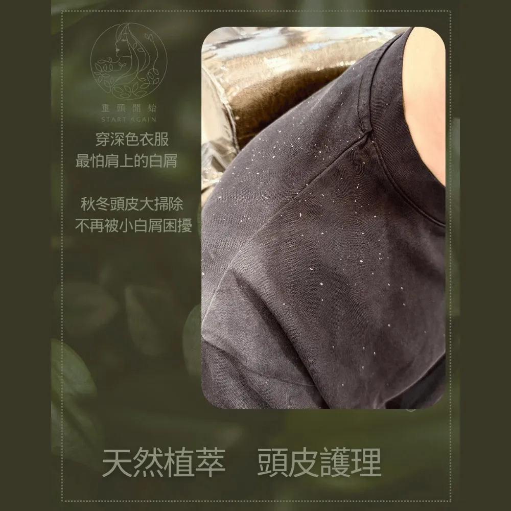 緩解肩膀出現頭皮屑的尷尬狀況