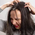 頭皮檢測找出問題