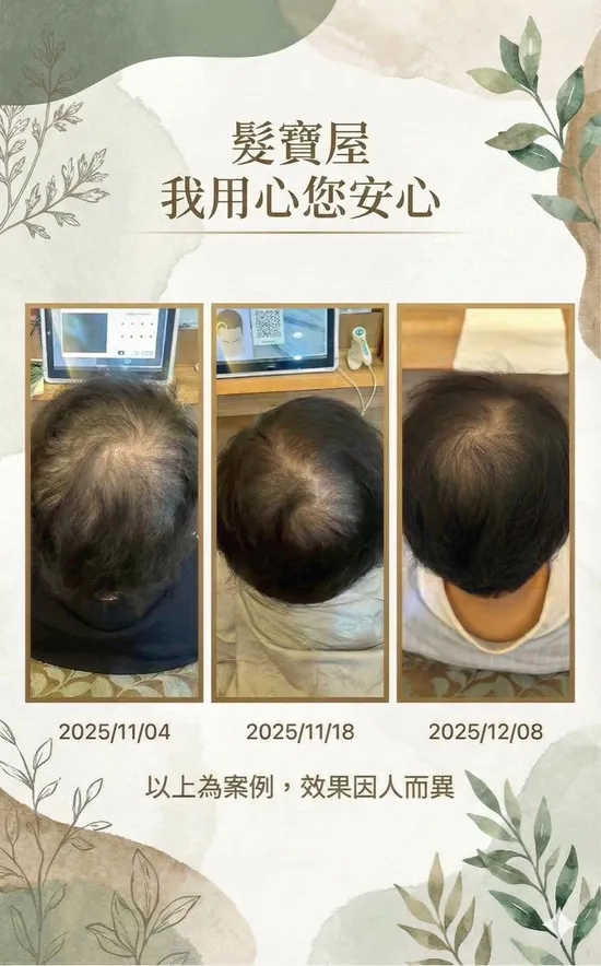 養出豐盈秀髮的根基：全方位頭皮舒壓與育髮工程指南