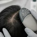 頭皮養護為什麼重要？認識健康頭皮與髮絲狀態的關係