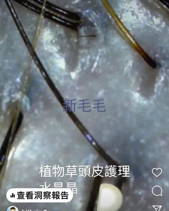 養出強韌秀髮：深層植物草頭皮護理，讓頭皮深呼吸