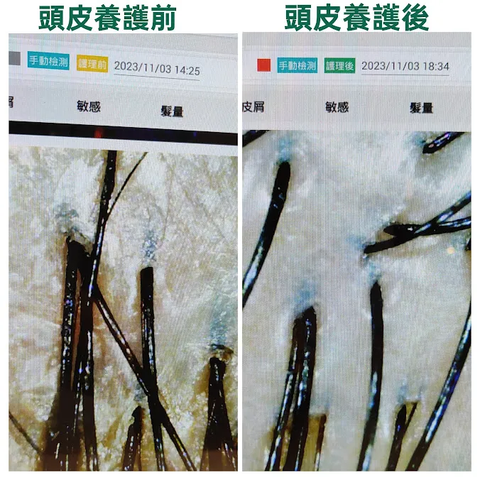桃園頭皮SPA