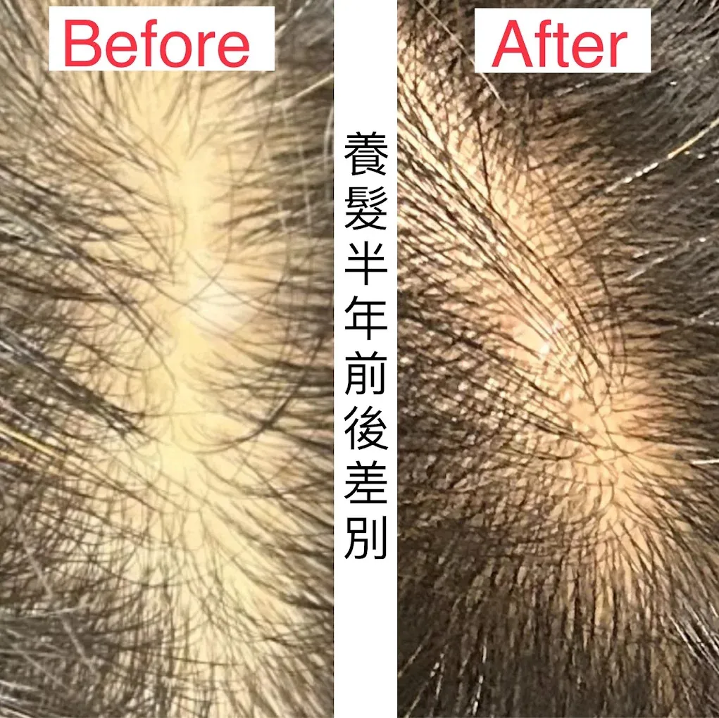 頭皮養護中心台北