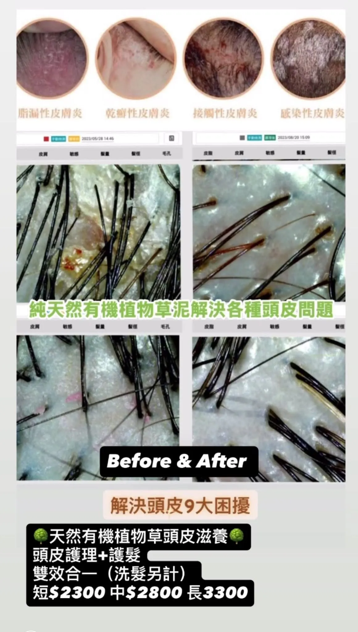 頭皮護理salon
