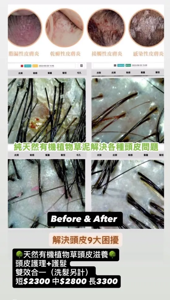 歲月不留痕:解析髮絲變化的奧秘與植萃養護哲學