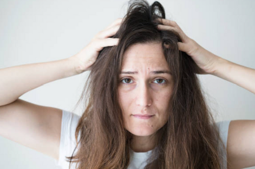 產後掉髮